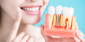 Bone Grafting for Dental Implants 300x150 1