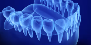 The Most Common Types Bone Grafting 300x150 1