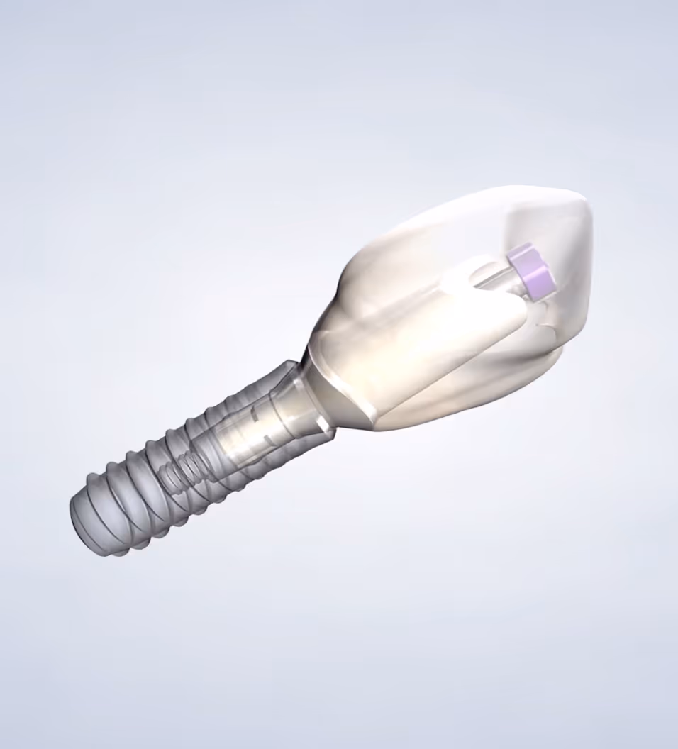 query  dental implants