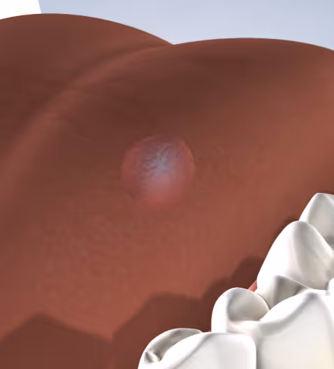 query  oral pathology