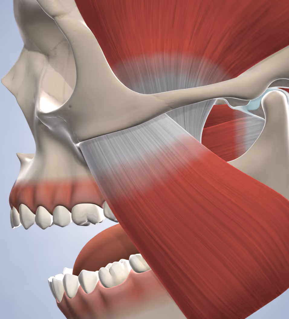 query  tmj