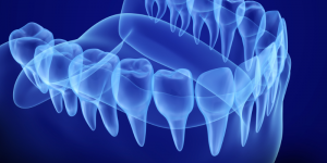 imaging of teeth