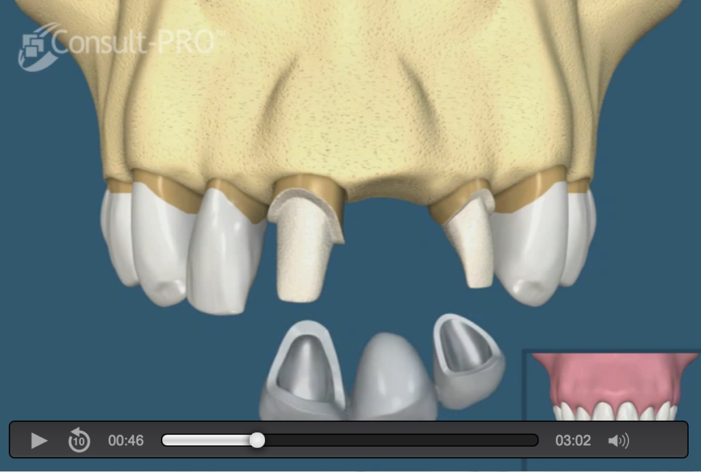bridge Naperville Oral and Maxillofacial Surgery