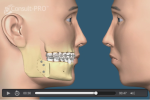 cephalometric tracing