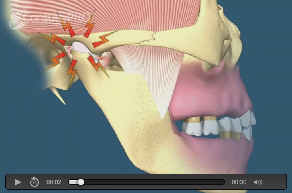 tmj Naperville Oral and Maxillofacial Surgery